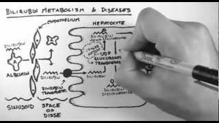 Bilirubin 2  Bilirubin Metabolism amp Diseases [upl. by Chloe454]