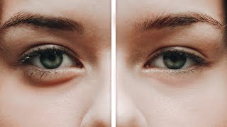 Reduce Dark Circles  Eye Bags  Photoshop [upl. by Amann]