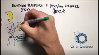 Estrogen Receptors amp HER2neu Receptors in Breast Cancer a TUTORIAL from Oster Oncology [upl. by Barnaba]