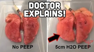 PEEP in 90 seconds  DOCTOR Explains [upl. by Lait]