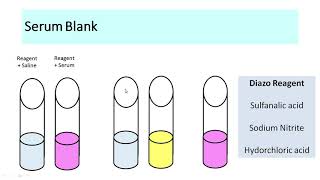 Serum bilirubin Estimation  english [upl. by Retsae]