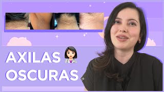 🥲¿Axilas oscuras Tips para cuidarlas [upl. by Treborsemaj]