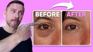 HOW TO MAKE EYE BAGS VANISH IN SECONDS FULL DEMO [upl. by Prasad664]