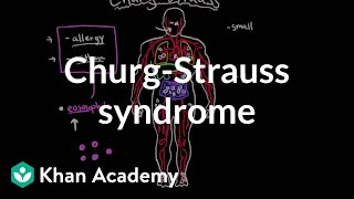 ChurgStrauss syndrome  Circulatory System and Disease  NCLEXRN  Khan Academy [upl. by Liberati110]