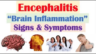 Encephalitis “Brain Inflammation” Signs and Symptoms amp Why They Occur [upl. by Oiromed]