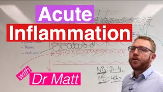 Acute Inflammation  Immunology [upl. by Fanchon]